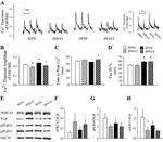 SERCA2 ATPase Antibody in Western Blot (WB)