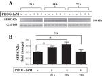 SERCA2 ATPase Antibody in Western Blot (WB)