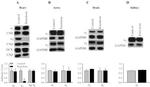 Sodium/Calcium Exchanger Antibody in Western Blot (WB)