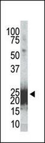 Phospho-BAD (Ser155) Antibody in Western Blot (WB)