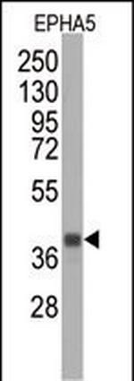 EphA5 Antibody in Western Blot (WB)