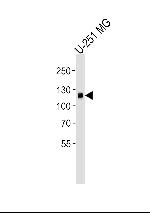 EphA5 Antibody in Western Blot (WB)