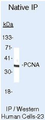 PCNA Antibody in Immunoprecipitation (IP)