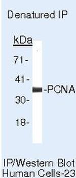 PCNA Antibody in Immunoprecipitation (IP)