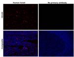 CD163 Antibody in Immunohistochemistry (Paraffin) (IHC (P))