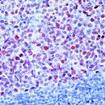 BCL6 Antibody in Immunohistochemistry (Paraffin) (IHC (P))