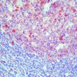 Caspase 3 Antibody in Immunohistochemistry (Paraffin) (IHC (P))