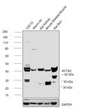 Alpha-Smooth Muscle Actin Antibody in Western Blot (WB)