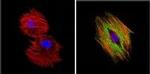 Alpha-Smooth Muscle Actin Antibody in Immunocytochemistry (ICC/IF)