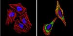 Alpha-Smooth Muscle Actin Antibody in Immunocytochemistry (ICC/IF)