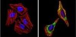 Alpha-Smooth Muscle Actin Antibody in Immunocytochemistry (ICC/IF)