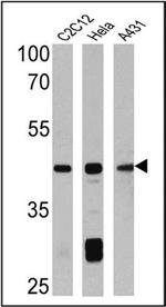 Alpha-Smooth Muscle Actin Antibody in Western Blot (WB)