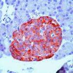 Synaptophysin Antibody in Immunohistochemistry (Paraffin) (IHC (P))