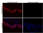 Cytokeratin 14 Antibody in Immunohistochemistry (Paraffin) (IHC (P))