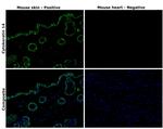 Cytokeratin 14 Antibody in Immunohistochemistry (Paraffin) (IHC (P))