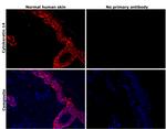 Cytokeratin 14 Antibody in Immunohistochemistry (Paraffin) (IHC (P))