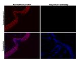 Cytokeratin 14 Antibody in Immunohistochemistry (Paraffin) (IHC (P))