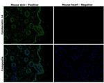 Cytokeratin 14 Antibody