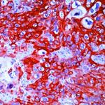 Cytokeratin 14 Antibody in Immunohistochemistry (Paraffin) (IHC (P))