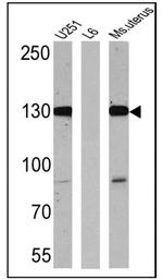 Caldesmon HMW Antibody in Western Blot (WB)