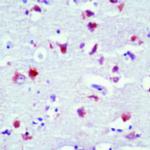 Rhodopsin Antibody in Immunohistochemistry (Paraffin) (IHC (P))