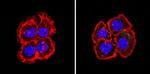 Bcl-2 Antibody in Immunocytochemistry (ICC/IF)