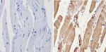 Actin Antibody in Immunohistochemistry (Paraffin) (IHC (P))