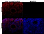 Vimentin Antibody in Immunohistochemistry (Paraffin) (IHC (P))