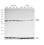 Vimentin Antibody in Western Blot (WB)