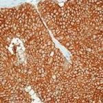 EpCAM Antibody in Immunohistochemistry (Paraffin) (IHC (P))