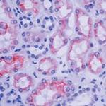 Villin Antibody in Immunohistochemistry (Paraffin) (IHC (P))