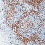 CD4 Antibody in Immunohistochemistry (Paraffin) (IHC (P))