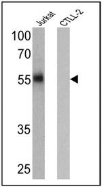 CD4 Antibody in Western Blot (WB)