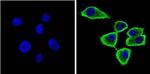 alpha Synuclein Antibody in Immunocytochemistry (ICC/IF)