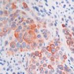 Cytokeratin 5/6 Antibody in Immunohistochemistry (Paraffin) (IHC (P))