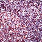 NPM1 Antibody in Immunohistochemistry (Paraffin) (IHC (P))