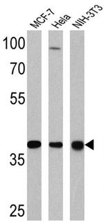 NPM1 Antibody in Western Blot (WB)