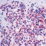 E-cadherin Antibody in Immunohistochemistry (Paraffin) (IHC (P))