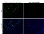 p53 Antibody in Immunohistochemistry (Paraffin) (IHC (P))