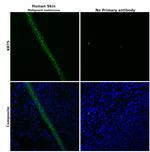 Cytokeratin 5 Antibody in Immunohistochemistry (Paraffin) (IHC (P))