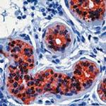 Cytokeratin 19 Antibody in Immunohistochemistry (Paraffin) (IHC (P))