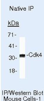 Cyclin D2 Antibody in Immunoprecipitation (IP)