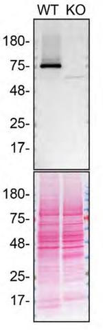 TGM2 Antibody