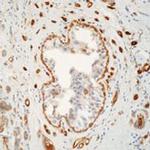 TGM2 Antibody in Immunohistochemistry (Paraffin) (IHC (P))