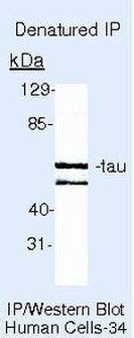 Tau Antibody in Immunoprecipitation (IP)