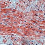 Prohibitin Antibody in Immunohistochemistry (Paraffin) (IHC (P))