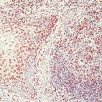 Ku70/Ku80 Antibody in Immunohistochemistry (Paraffin) (IHC (P))