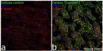 Cardiac Troponin T Antibody in Immunohistochemistry (Frozen) (IHC (F))