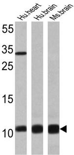 S100 Antibody in Western Blot (WB)