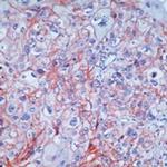 EGFR Antibody in Immunohistochemistry (Paraffin) (IHC (P))